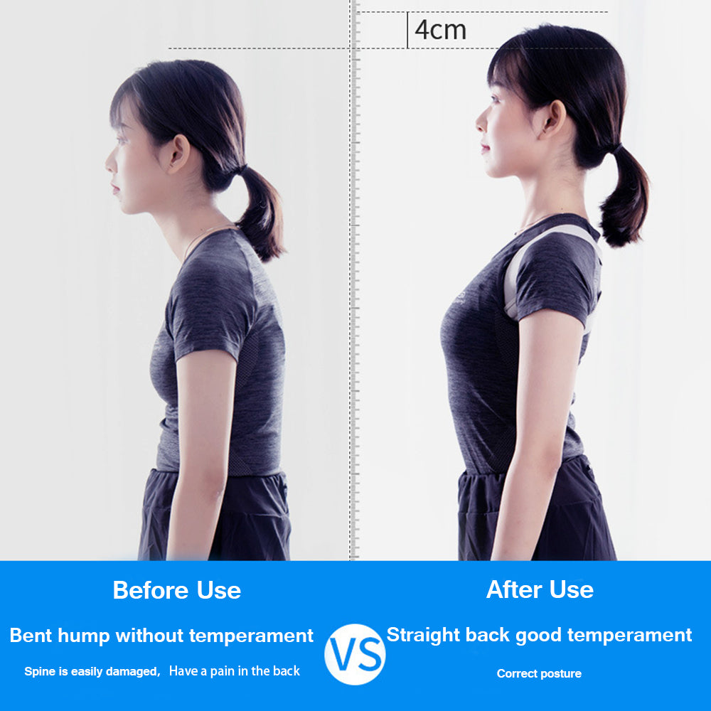 Smart Back Brace Posture Corrector Intelligent Inductive Adult Child Artifact Hunchback Correction Belt Office Sport Fitness - ultrsbeauty