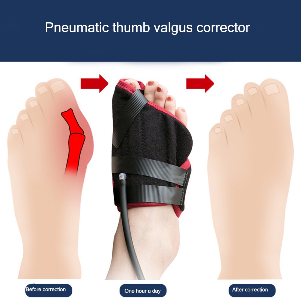 Pneumatic Bunion Corrector Toe Straightener Big Toe Splints Brace with Pneumatic Bag for Hallux Valgus Hammer Foot Pain Relief - ultrsbeauty