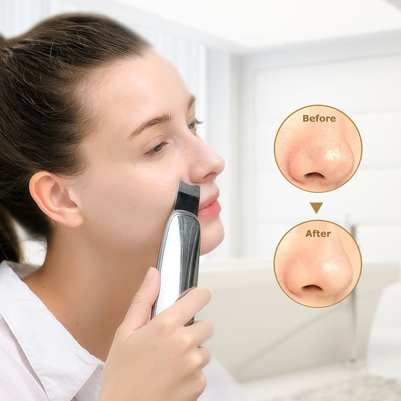 TOUCHBeauty ultrasonic face cleaning Face Skin Scrubber to Remove Blackheads Peeling Wrinkle Anti-Age Cordless Face Spa Device - ultrsbeauty